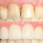 1 üzleti kép DENT-A-LUX FOGÁSZAT KECSKEMÉT, DR. KŐHALMI TAMÁS FOGORVOS - WWW.DENTALUX.HU Fogászat, fogszabályzás ban/ben Kecskemét BK