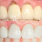 2 üzleti kép DENT-A-LUX FOGÁSZAT KECSKEMÉT, DR. KŐHALMI TAMÁS FOGORVOS - WWW.DENTALUX.HU Fogászat, fogszabályzás ban/ben Kecskemét BK