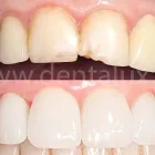 6 üzleti kép DENT-A-LUX FOGÁSZAT KECSKEMÉT, DR. KŐHALMI TAMÁS FOGORVOS - WWW.DENTALUX.HU ban/ben Kecskemét BK
