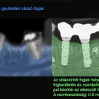 8 üzleti kép DENT-A-LUX FOGÁSZAT KECSKEMÉT, DR. KŐHALMI TAMÁS FOGORVOS - WWW.DENTALUX.HU ban/ben Kecskemét BK
