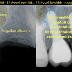 9 üzleti kép DENT-A-LUX FOGÁSZAT KECSKEMÉT, DR. KŐHALMI TAMÁS FOGORVOS - WWW.DENTALUX.HU ban/ben Kecskemét BK