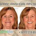 5 üzleti kép DENT ELITE FOGSZAKORVOSI ÉS SZÁJSEBÉSZETI KÖZPONT Fogtechnika ban/ben Budapest