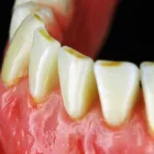 11 üzleti kép RÁTONYI FOGTECHNIKA Fogtechnika ban/ben Ráckeve PE