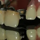 17 üzleti kép RÁTONYI FOGTECHNIKA Fogtechnika ban/ben Ráckeve PE