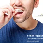 1 üzleti kép RELAX DENTAL IMPLANTOLÓGIAI ÉS ESZTÉTIKAI FOGÁSZATI KÖZPONT Orvosok fogorvosok ban/ben Kecskemét BK