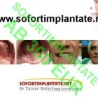 7 üzleti kép SOFORTIMPLANTATE, SOFORT BELASTBARE ZAHNIMPLANTATE, IMPLANTOLOGIE DR CZÍNER ZAHNARZTPRAXIS Fogászat, fogszabályzás ban/ben Sopron GS