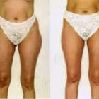 3 üzleti kép ZSÍRLESZÍVÁS KLINIKA DR LÁNYI CECÍLIA Plasztikai sebészet ban/ben Budapest