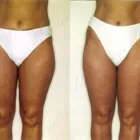 7 üzleti kép ZSÍRLESZÍVÁS KLINIKA DR LÁNYI CECÍLIA Plasztikai sebészet ban/ben Budapest