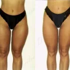 9 üzleti kép ZSÍRLESZÍVÁS KLINIKA DR LÁNYI CECÍLIA Plasztikai sebészet ban/ben Budapest