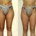 10 üzleti kép ZSÍRLESZÍVÁS KLINIKA DR LÁNYI CECÍLIA Plasztikai sebészet ban/ben Budapest