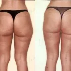 11 üzleti kép ZSÍRLESZÍVÁS KLINIKA DR LÁNYI CECÍLIA Plasztikai sebészet ban/ben Budapest