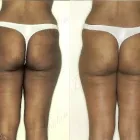 12 üzleti kép ZSÍRLESZÍVÁS KLINIKA DR LÁNYI CECÍLIA Plasztikai sebészet ban/ben Budapest