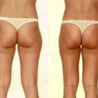 13 üzleti kép ZSÍRLESZÍVÁS KLINIKA DR LÁNYI CECÍLIA Plasztikai sebészet ban/ben Budapest