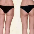 14 üzleti kép ZSÍRLESZÍVÁS KLINIKA DR LÁNYI CECÍLIA Plasztikai sebészet ban/ben Budapest