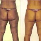 16 üzleti kép ZSÍRLESZÍVÁS KLINIKA DR LÁNYI CECÍLIA Plasztikai sebészet ban/ben Budapest