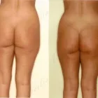 17 üzleti kép ZSÍRLESZÍVÁS KLINIKA DR LÁNYI CECÍLIA Plasztikai sebészet ban/ben Budapest