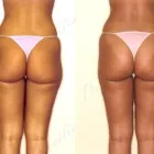 18 üzleti kép ZSÍRLESZÍVÁS KLINIKA DR LÁNYI CECÍLIA Plasztikai sebészet ban/ben Budapest