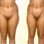 19 üzleti kép ZSÍRLESZÍVÁS KLINIKA DR LÁNYI CECÍLIA Plasztikai sebészet ban/ben Budapest