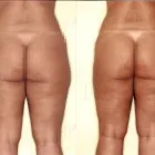 21 üzleti kép ZSÍRLESZÍVÁS KLINIKA DR LÁNYI CECÍLIA Plasztikai sebészet ban/ben Budapest