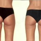 22 üzleti kép ZSÍRLESZÍVÁS KLINIKA DR LÁNYI CECÍLIA Plasztikai sebészet ban/ben Budapest