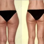 25 üzleti kép ZSÍRLESZÍVÁS KLINIKA DR LÁNYI CECÍLIA Plasztikai sebészet ban/ben Budapest