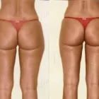 26 üzleti kép ZSÍRLESZÍVÁS KLINIKA DR LÁNYI CECÍLIA Plasztikai sebészet ban/ben Budapest