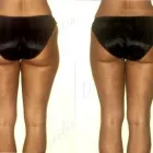 27 üzleti kép ZSÍRLESZÍVÁS KLINIKA DR LÁNYI CECÍLIA Plasztikai sebészet ban/ben Budapest