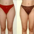 29 üzleti kép ZSÍRLESZÍVÁS KLINIKA DR LÁNYI CECÍLIA Plasztikai sebészet ban/ben Budapest