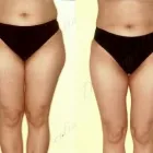 30 üzleti kép ZSÍRLESZÍVÁS KLINIKA DR LÁNYI CECÍLIA Plasztikai sebészet ban/ben Budapest