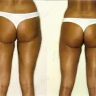 31 üzleti kép ZSÍRLESZÍVÁS KLINIKA DR LÁNYI CECÍLIA Plasztikai sebészet ban/ben Budapest