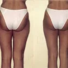 33 üzleti kép ZSÍRLESZÍVÁS KLINIKA DR LÁNYI CECÍLIA Plasztikai sebészet ban/ben Budapest