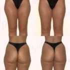 34 üzleti kép ZSÍRLESZÍVÁS KLINIKA DR LÁNYI CECÍLIA Plasztikai sebészet ban/ben Budapest