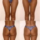 35 üzleti kép ZSÍRLESZÍVÁS KLINIKA DR LÁNYI CECÍLIA Plasztikai sebészet ban/ben Budapest