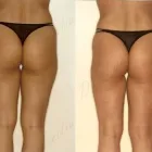 36 üzleti kép ZSÍRLESZÍVÁS KLINIKA DR LÁNYI CECÍLIA Plasztikai sebészet ban/ben Budapest