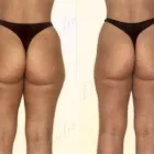 39 üzleti kép ZSÍRLESZÍVÁS KLINIKA DR LÁNYI CECÍLIA Plasztikai sebészet ban/ben Budapest