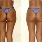 40 üzleti kép ZSÍRLESZÍVÁS KLINIKA DR LÁNYI CECÍLIA Plasztikai sebészet ban/ben Budapest