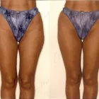 41 üzleti kép ZSÍRLESZÍVÁS KLINIKA DR LÁNYI CECÍLIA Plasztikai sebészet ban/ben Budapest