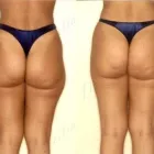 42 üzleti kép ZSÍRLESZÍVÁS KLINIKA DR LÁNYI CECÍLIA Plasztikai sebészet ban/ben Budapest