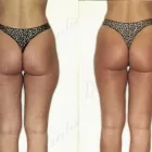 43 üzleti kép ZSÍRLESZÍVÁS KLINIKA DR LÁNYI CECÍLIA Plasztikai sebészet ban/ben Budapest