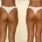 44 üzleti kép ZSÍRLESZÍVÁS KLINIKA DR LÁNYI CECÍLIA Plasztikai sebészet ban/ben Budapest