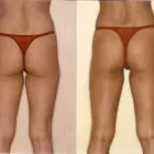 46 üzleti kép ZSÍRLESZÍVÁS KLINIKA DR LÁNYI CECÍLIA Plasztikai sebészet ban/ben Budapest