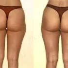 47 üzleti kép ZSÍRLESZÍVÁS KLINIKA DR LÁNYI CECÍLIA Plasztikai sebészet ban/ben Budapest