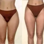 48 üzleti kép ZSÍRLESZÍVÁS KLINIKA DR LÁNYI CECÍLIA Plasztikai sebészet ban/ben Budapest