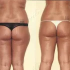 51 üzleti kép ZSÍRLESZÍVÁS KLINIKA DR LÁNYI CECÍLIA Plasztikai sebészet ban/ben Budapest