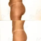 53 üzleti kép ZSÍRLESZÍVÁS KLINIKA DR LÁNYI CECÍLIA Plasztikai sebészet ban/ben Budapest