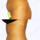 58 üzleti kép ZSÍRLESZÍVÁS KLINIKA DR LÁNYI CECÍLIA Plasztikai sebészet ban/ben Budapest