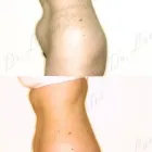 59 üzleti kép ZSÍRLESZÍVÁS KLINIKA DR LÁNYI CECÍLIA Plasztikai sebészet ban/ben Budapest