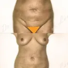 61 üzleti kép ZSÍRLESZÍVÁS KLINIKA DR LÁNYI CECÍLIA Plasztikai sebészet ban/ben Budapest