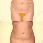 63 üzleti kép ZSÍRLESZÍVÁS KLINIKA DR LÁNYI CECÍLIA Plasztikai sebészet ban/ben Budapest