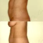 67 üzleti kép ZSÍRLESZÍVÁS KLINIKA DR LÁNYI CECÍLIA Plasztikai sebészet ban/ben Budapest